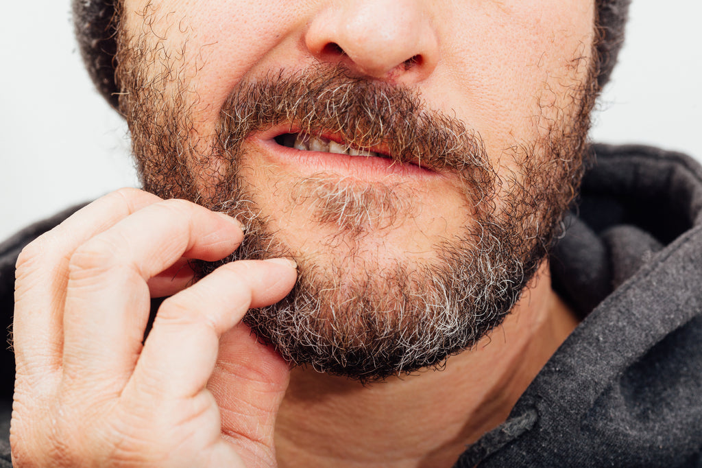 beard oil for dandruff